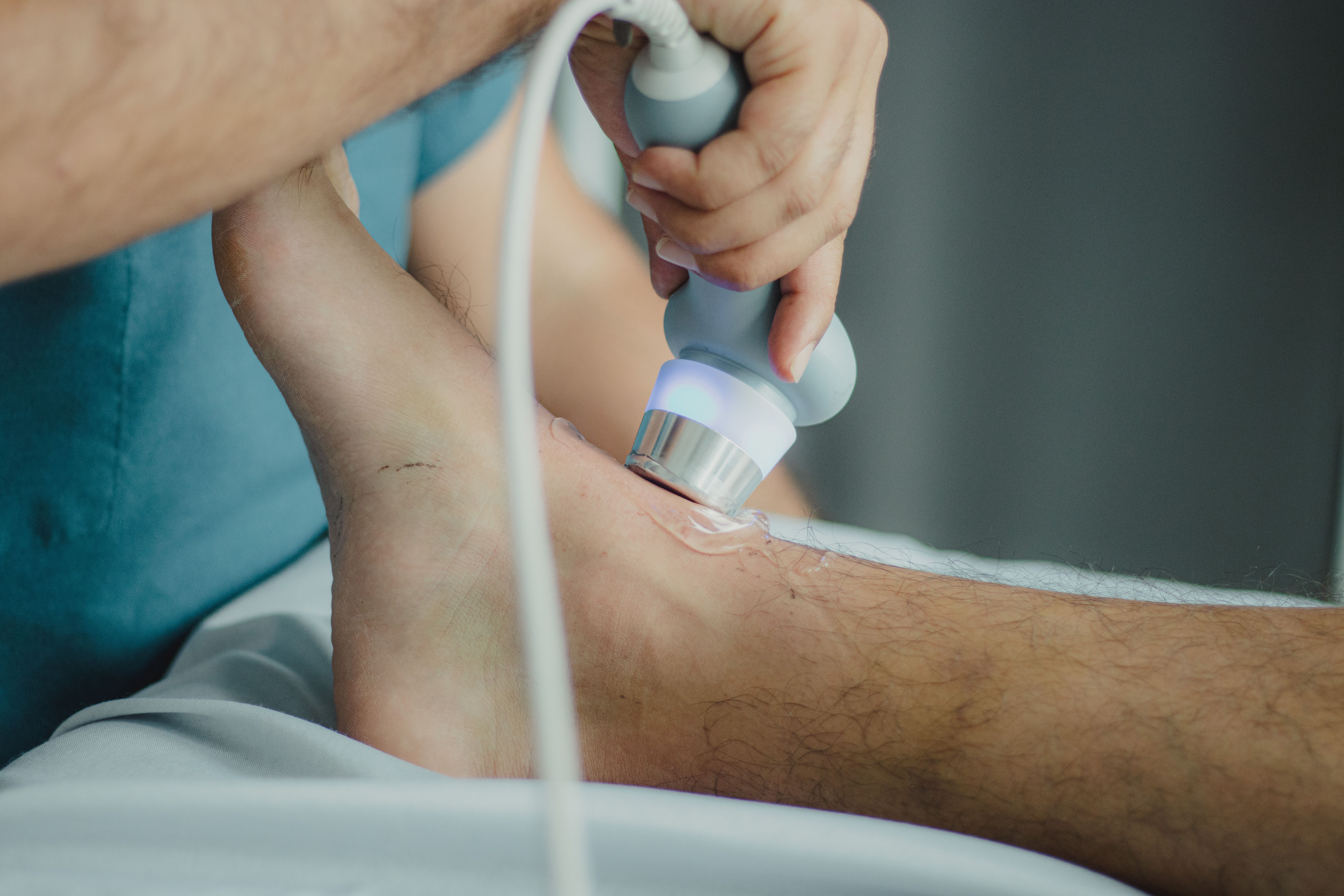 Radial ESWT treatment